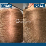 Ампули против косопад и за стимулиране на растежа на косата с пептиди 4-седмична терапия 10 бр. х 2 мл